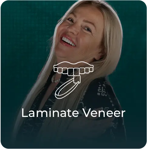 laminate https://esnan.co/wp-content/uploads/2024/08/laminate-1.webp