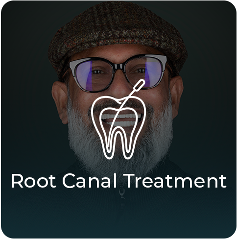 Root-Canal-Treatment https://esnan.co/wp-content/uploads/2025/02/Root-Canal-Treatment.png